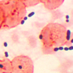 Enterococcus