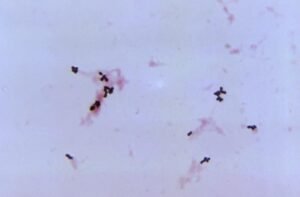 Rothia mucilaginosa – microregistrar.com