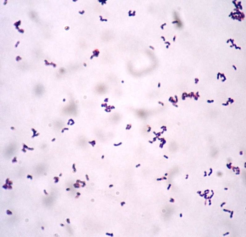 Actinotignum schaalii gram stain (pic Manurx27, Wikipedia)