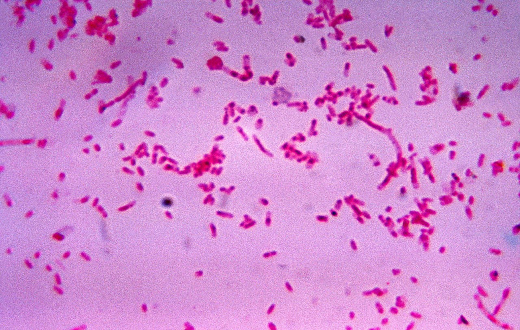 Fusobacterium IWikipedia)